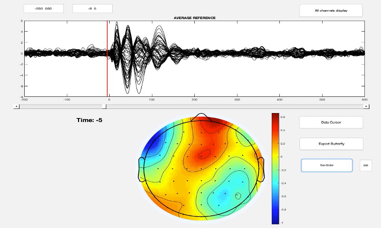 TEP output with waveform trace and scalp topography map.
